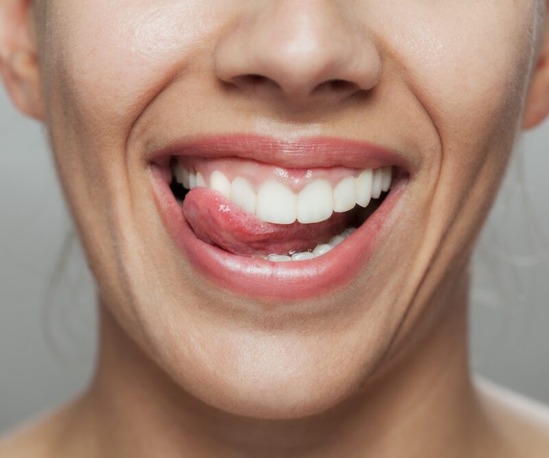 Are Pop-On Veneers® comfortable to wear all day?