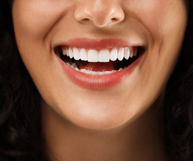 The Dental Implant Process: Should you choose upper or lower Jaw Implants for best results?