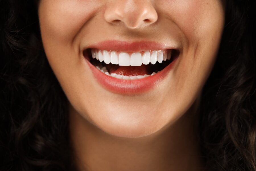 The Dental Implant Process: Should you choose upper or lower Jaw Implants for best results?